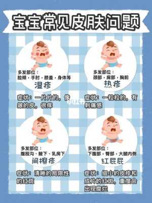 孕期怎么预防婴儿湿疹(怀孕期间一直长湿疹,对宝宝有没有影响) 第3张 孕期怎么预防婴儿湿疹(怀孕期间一直长湿疹,对宝宝有没有影响) 第3张
