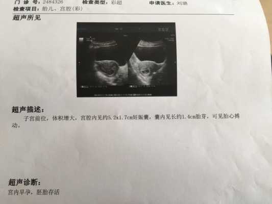 70天没有胎心还能留吗,胎儿没有胎心还会长么 第1张 70天没有胎心还能留吗,胎儿没有胎心还会长么 第1张