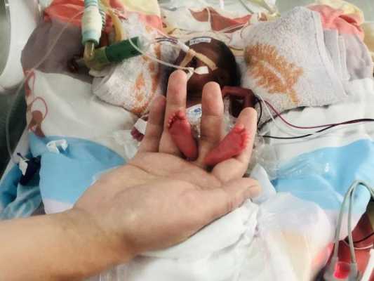 24周胎儿早产能存活吗（24周胎儿早产能存活吗多久）  第1张