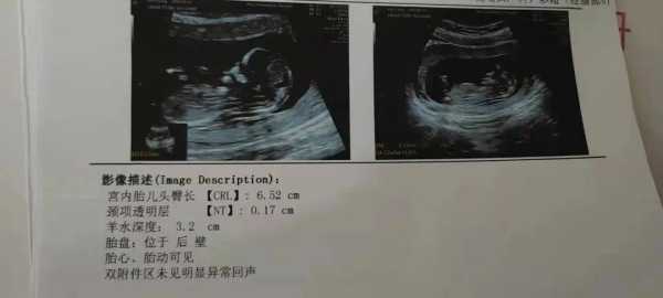 b超看胎儿体重准吗(胎儿体重(克):482(+-70克)是多少斤) 第2张 b超看胎儿体重准吗(胎儿体重(克):482(+-70克)是多少斤) 第2张
