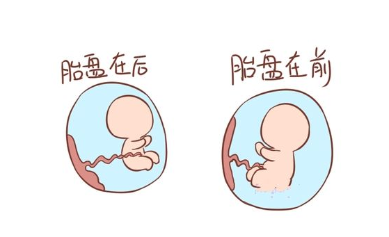 胎盘前壁和后壁胎儿图(胎盘前壁和后壁胎儿图片对比) 第3张 胎盘前壁和后壁胎儿图(胎盘前壁和后壁胎儿图片对比) 第3张