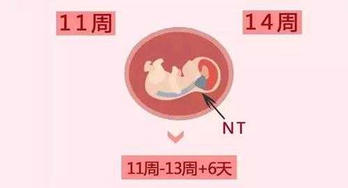 胎儿nt增厚原因有什么,胎儿nt增厚原因有三种类型 第2张 胎儿nt增厚原因有什么,胎儿nt增厚原因有三种类型 第2张