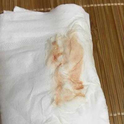 孕期第八周(孕期第八周有一点出血) 第3张 孕期第八周(孕期第八周有一点出血) 第3张