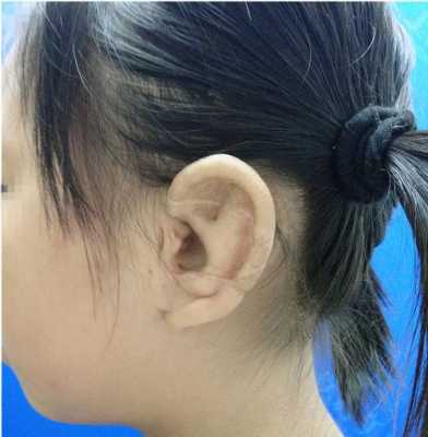 胎儿耳朵发育的关键期(胎儿耳朵发育的关键期是几个月) 第3张 胎儿耳朵发育的关键期(胎儿耳朵发育的关键期是几个月) 第3张