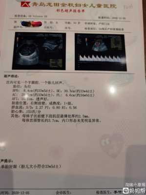 怀孕35周了,胎儿偏小怎么办,35周胎儿偏小怎么补救 第1张 怀孕35周了,胎儿偏小怎么办,35周胎儿偏小怎么补救 第1张