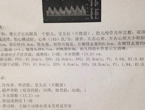 孕36周b超偏小两周该怎么办,医生建议我多吃点东西,但是我真的没胃口啊,36周胎儿偏小一周正常吗 第2张 孕36周b超偏小两周该怎么办,医生建议我多吃点东西,但是我真的没胃口啊,36周胎儿偏小一周正常吗 第2张