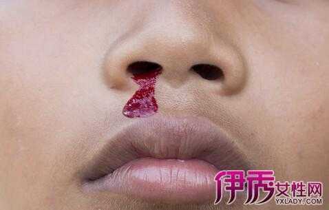 孕期鼻子流血怎么回事(孕期鼻子流血怎么回事儿) 第1张 孕期鼻子流血怎么回事(孕期鼻子流血怎么回事儿) 第1张