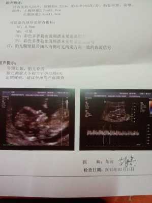 胎儿NT正常值是多少,胎儿NT值是什么意思 第2张 胎儿NT正常值是多少,胎儿NT值是什么意思 第2张