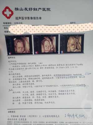 17周胎儿彩超图（17周胎儿彩超图片）  第2张