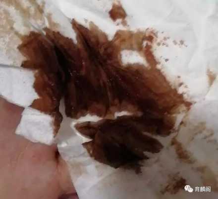 怀孕初期有褐色黑色血块，需要安胎吗,孕期出现黑色血块  第2张