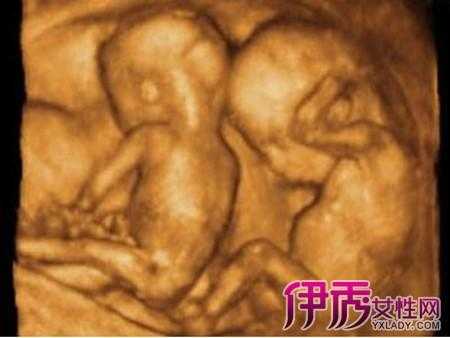 孕5月胎儿大小（5月龄宝宝能看多少米）  第1张