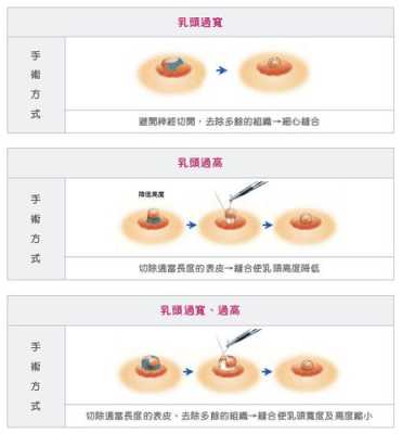 孕期乳头开裂怎么办(乳头根部裂开怎么办) 第2张 孕期乳头开裂怎么办(乳头根部裂开怎么办) 第2张