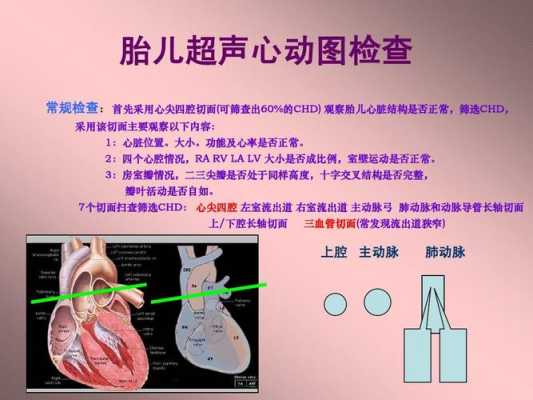 胎儿超声心动怎么检查(胎儿超声心动怎么检查) 第2张 胎儿超声心动怎么检查(胎儿超声心动怎么检查) 第2张