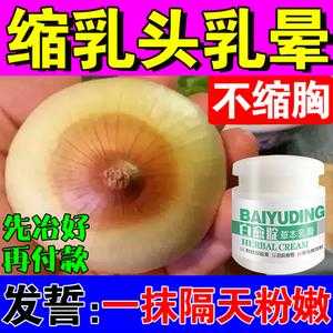 怀孕期间乳头变黑(怀孕期间乳头变黑是怎么回事) 第2张 怀孕期间乳头变黑(怀孕期间乳头变黑是怎么回事) 第2张
