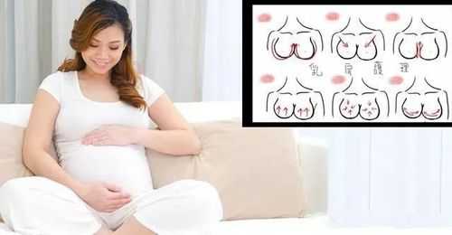 孕期胸涨怎么办（孕期胸涨怎么办）  第1张