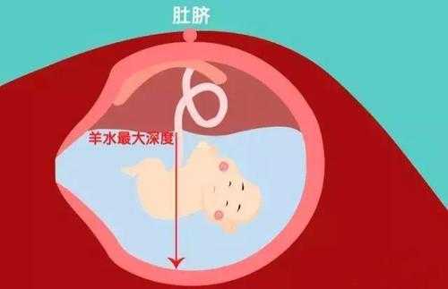孕妇羊水少对胎儿有什么影响,孕期羊水少对胎儿影响大吗 第3张 孕妇羊水少对胎儿有什么影响,孕期羊水少对胎儿影响大吗 第3张
