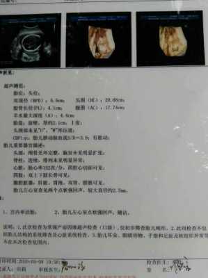 做四维显示左心室有强回声,胎儿左心房有强回声点 第2张 做四维显示左心室有强回声,胎儿左心房有强回声点 第2张