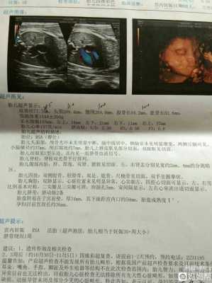 右肾分离的胎儿是男孩（右肾分离的胎儿是男孩）  第1张