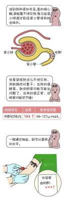 孕期肌酐偏低怎么办,孕期肌酐偏低的原因及危害有哪些  第2张