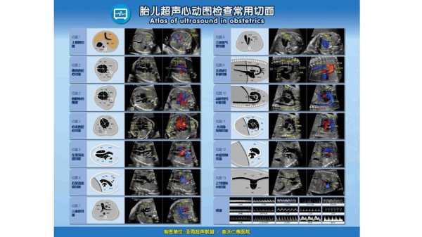 胎儿心脏有两个点是怎么回事,胎儿超声心动图检查多少钱 第2张 胎儿心脏有两个点是怎么回事,胎儿超声心动图检查多少钱 第2张