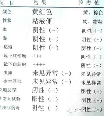 孕期尿白细胞2十(小儿大便白细胞2个加号什么意思?这说明有感染了吗) 第1张 孕期尿白细胞2十(小儿大便白细胞2个加号什么意思?这说明有感染了吗) 第1张