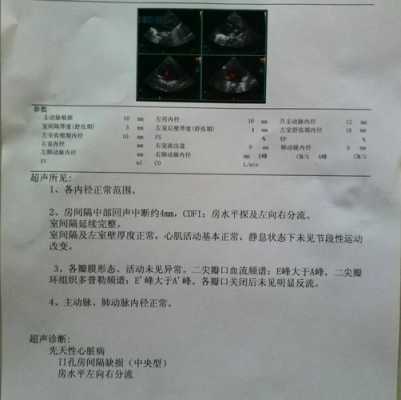 胎儿心脏超声检查多少钱,胎儿系统超声检查多少钱  第1张