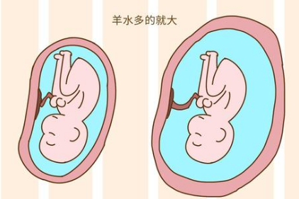羊水少胎儿会畸形吗(羊水少胎儿会畸形吗图片) 第2张 羊水少胎儿会畸形吗(羊水少胎儿会畸形吗图片) 第2张