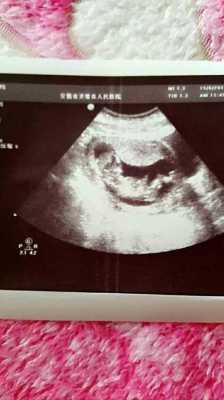 85天的宝宝能看清人吗,85天的胎儿有多大图片 第2张 85天的宝宝能看清人吗,85天的胎儿有多大图片 第2张