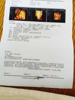 怀孕31周彩超发现胎儿心脏左室内一小强光点，请求解答，谢谢,怀孕31周胎儿彩超看男女  第1张