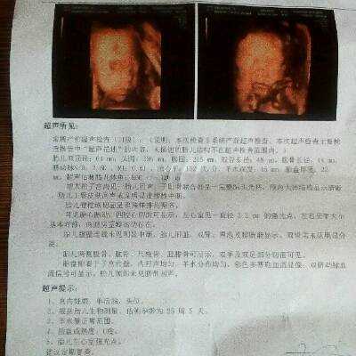 怀孕31周彩超发现胎儿心脏左室内一小强光点，请求解答，谢谢,怀孕31周胎儿彩超看男女  第2张