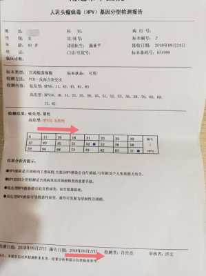 HPV查出来是阳性对胎儿有影响吗,能不能顺产,hpv病毒对胎儿的影响大吗 第2张 HPV查出来是阳性对胎儿有影响吗,能不能顺产,hpv病毒对胎儿的影响大吗 第2张