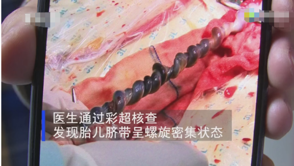 八月大的胎儿(八月大的胎儿有多重) 第2张 八月大的胎儿(八月大的胎儿有多重) 第2张