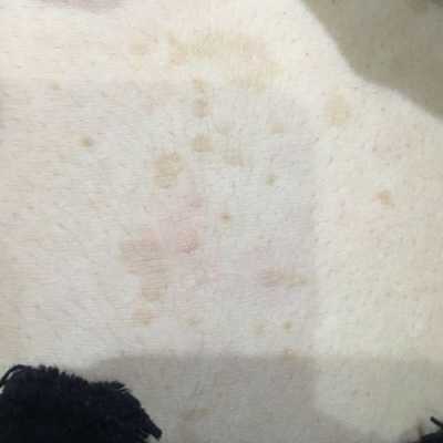 突然身上长了很多的褐色斑,孕期身上起褐色的花斑怎么回事 第2张 突然身上长了很多的褐色斑,孕期身上起褐色的花斑怎么回事 第2张
