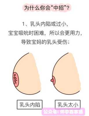 哺乳期乳头皲裂怎么快速治愈,孕期乳头皲裂怎么办才 第2张 哺乳期乳头皲裂怎么快速治愈,孕期乳头皲裂怎么办才 第2张