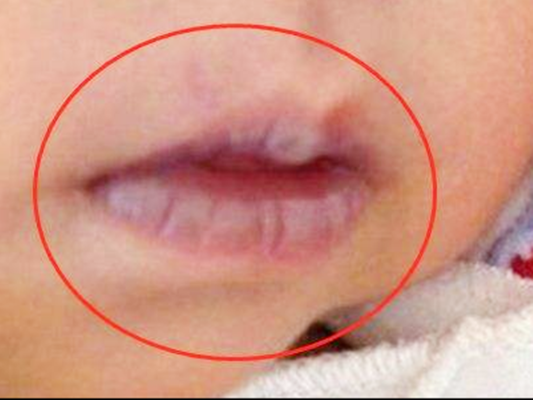 新生儿嘴巴吐泡泡怎么回事,胎儿在肚子里吐泡泡怎么回事 第2张 新生儿嘴巴吐泡泡怎么回事,胎儿在肚子里吐泡泡怎么回事 第2张