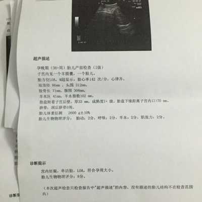 胎儿超声生物物理评分8分(胎儿心跳170正常吗) 第2张 胎儿超声生物物理评分8分(胎儿心跳170正常吗) 第2张