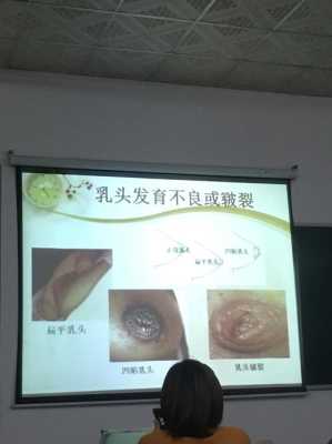 孕期乳头干裂怎么办(孕期乳头干裂怎么办呢) 第1张 孕期乳头干裂怎么办(孕期乳头干裂怎么办呢) 第1张