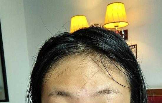 怀孕脸色发黄是什么原因,孕期脸色发黄怎么办呢 第2张 怀孕脸色发黄是什么原因,孕期脸色发黄怎么办呢 第2张
