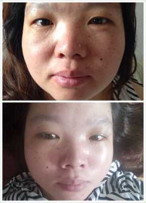 怀孕脸色发黄是什么原因,孕期脸色发黄怎么办呢 第3张 怀孕脸色发黄是什么原因,孕期脸色发黄怎么办呢 第3张