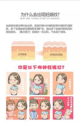 孕期妊娠纹怎样消除(如何去肚子的妊娠纹) 第2张 孕期妊娠纹怎样消除(如何去肚子的妊娠纹) 第2张