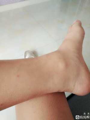 孕期腿肿是男孩女孩(孕期腿脚浮肿怎么办) 第2张 孕期腿肿是男孩女孩(孕期腿脚浮肿怎么办) 第2张