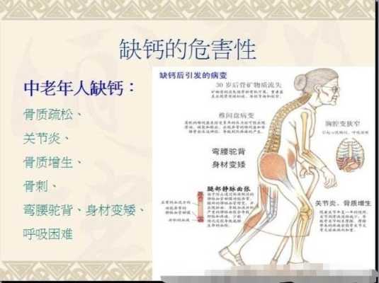 孕期缺钙的表现有哪些(孕期缺钙的表现有哪些症状) 第2张 孕期缺钙的表现有哪些(孕期缺钙的表现有哪些症状) 第2张