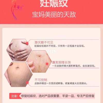 孕期怎么控制妊娠纹(怎么遮住妊娠纹) 第3张 孕期怎么控制妊娠纹(怎么遮住妊娠纹) 第3张