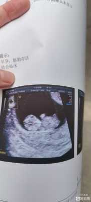 怀孕10周胎儿彩超图片（怀孕10周胎儿彩超图片）  第1张