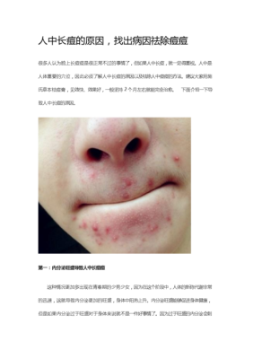孕期人中长痘的原因（孕期人中长痘痘什么原因）  第1张