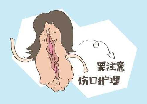 孕期有炎症可以顺产吗(孕期有炎症可以顺产吗有影响吗) 第2张 孕期有炎症可以顺产吗(孕期有炎症可以顺产吗有影响吗) 第2张