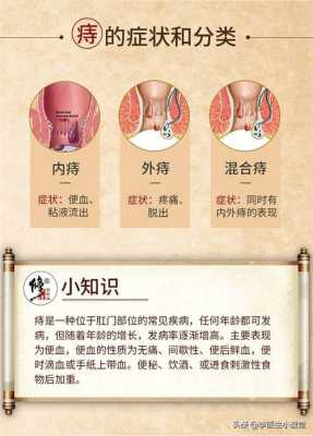 孕期外痔怎么治疗方法(孕期外痔怎么治疗方法图片) 第1张 孕期外痔怎么治疗方法(孕期外痔怎么治疗方法图片) 第1张