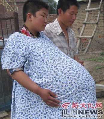 孕妇生殖器疱疹对胎儿(孕妇患了生殖器疱疹可以顺产吗) 第1张 孕妇生殖器疱疹对胎儿(孕妇患了生殖器疱疹可以顺产吗) 第1张