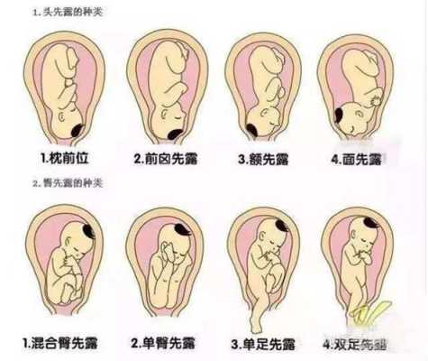 七个月胎儿胎位(七个月胎儿胎位头朝上正常吗) 第1张 七个月胎儿胎位(七个月胎儿胎位头朝上正常吗) 第1张