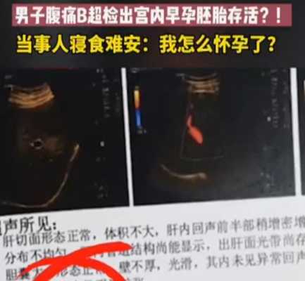 孕期B超标准数据(为什么怀孕实际天数跟B超不一样) 第2张 孕期B超标准数据(为什么怀孕实际天数跟B超不一样) 第2张